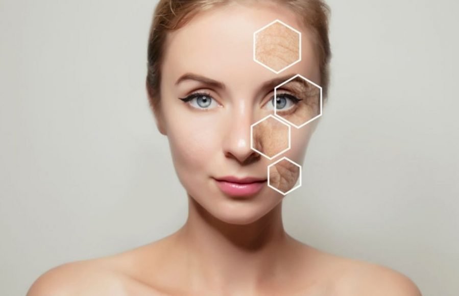 Kinesia360